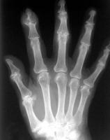 /album/gota/gota-i-png/